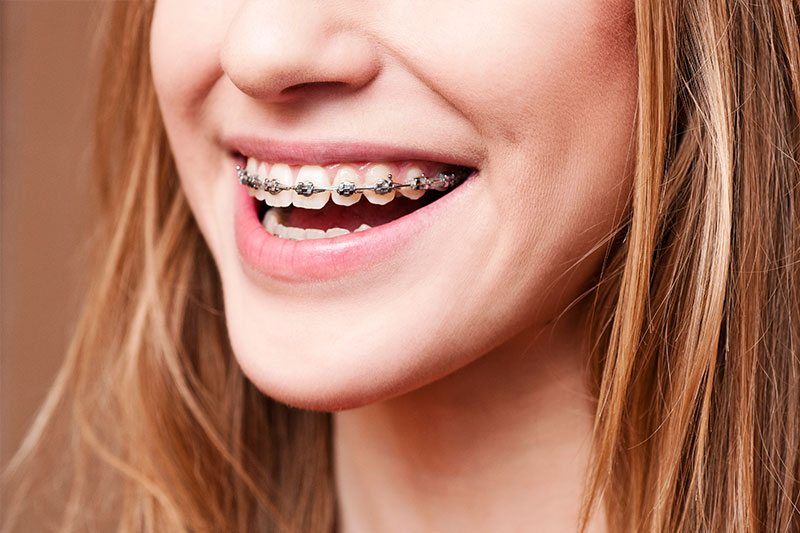 Orthodontics in York