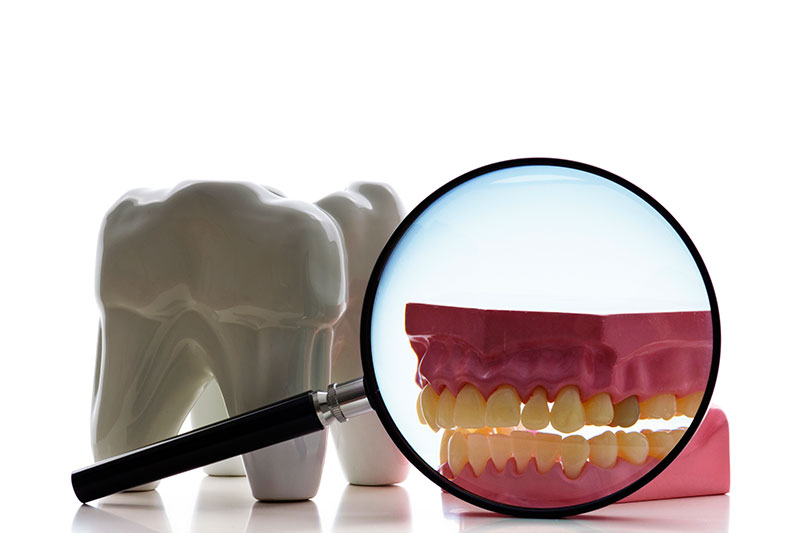 Root Canal Treatment in York