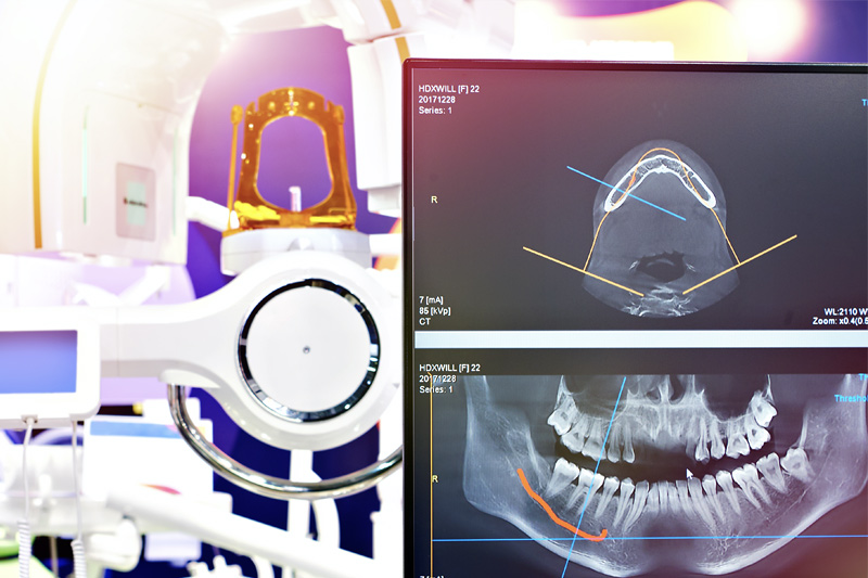 Digital X-Rays in York